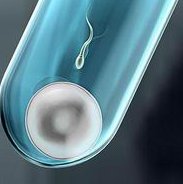 哈尔滨囊卵巢患者海南试管，三代技术+促排方案优化，成功率70%+